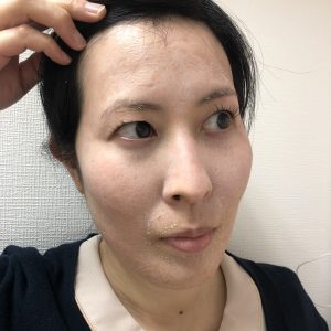 ARナイトリペアの裏技 | 銀座・日比谷の美容皮膚科 ゆかスキンクリニック